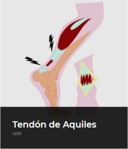 Rotura tendon de aquiles - ECiPP 