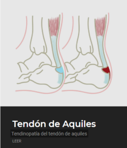 Tendinopatia - ECiPP 